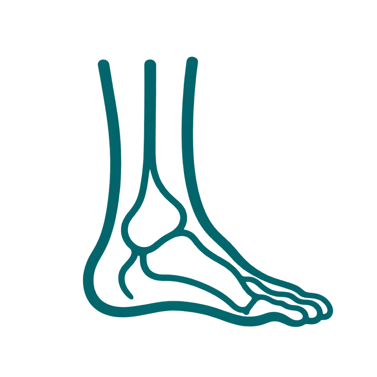 Ankle injuries