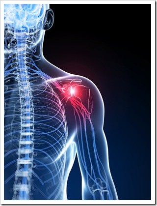 frozen-shoulder-neck-pain-b