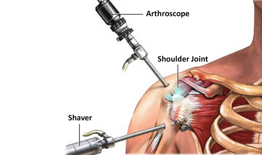 surgery (1)
