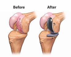 surgery