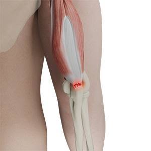 distal-banner