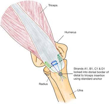 distal-overview