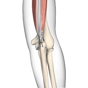 distal-surgery